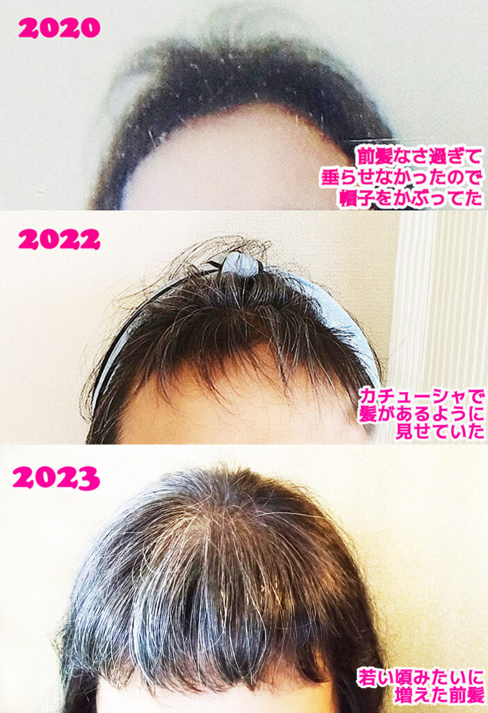 育毛　成功例　2023